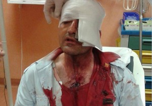 lucchese_ezio_aggressione_ildesk