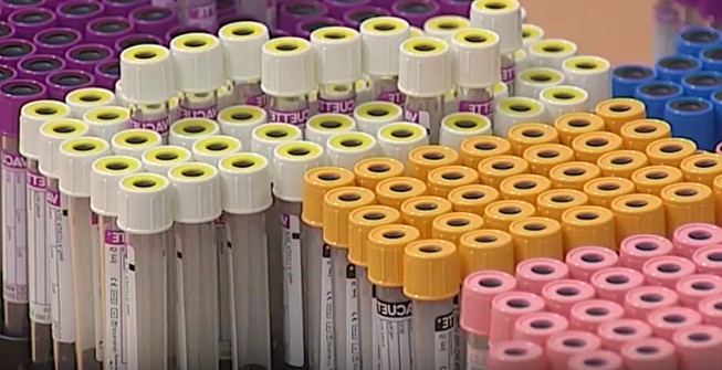 Donatori sangue, nuovi dati confermano il boom di positivi in Campania