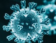 Coronavirus, un caso a Ischia: in Campania sono 31
