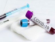 Coronavirus, Campania: 34 guariti, 2 in terapia intensiva e nessun decesso