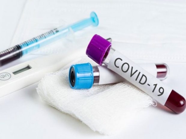 Coronavirus, in Campania stabile trend di contagiati. In lieve calo nel Paese
