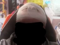 Napoli, follia nel metrò: guardia giurata presa a martellate in testa