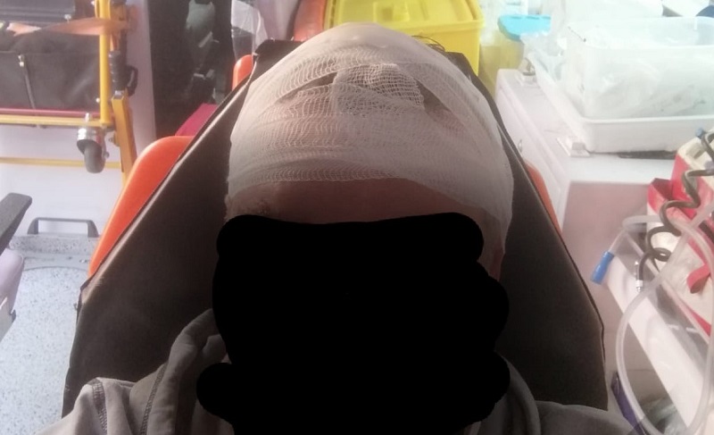 Napoli, follia nel metrò: guardia giurata presa a martellate in testa